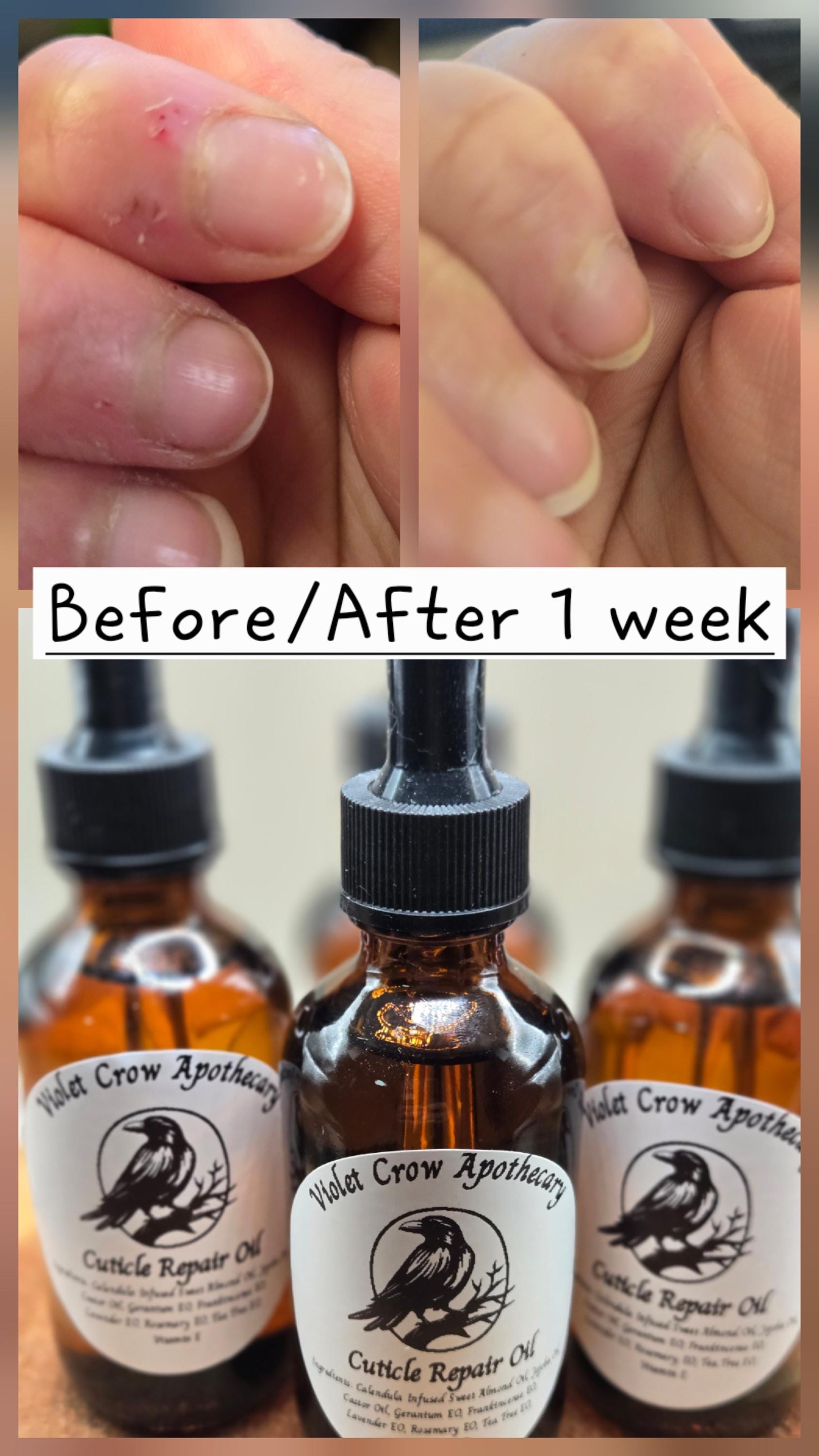 Herbal Cuticle Oil | Calendula Infused Nail & Skin Care | 2oz Dropper Bottle | Essential Oils | Dry Cuticle Repair | Clean Beauty